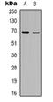 Rho-related BTB domain-containing protein 3 antibody, orb318886, Biorbyt, Western Blot image 