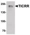 TOPBP1 Interacting Checkpoint And Replication Regulator antibody, PA5-38053, Invitrogen Antibodies, Western Blot image 