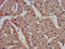 Interleukin 1 Receptor Accessory Protein Like 1 antibody, LS-C673742, Lifespan Biosciences, Immunohistochemistry paraffin image 