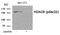 Histone Deacetylase 6 antibody, 80-033, ProSci, Western Blot image 