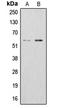 Aldehyde Dehydrogenase 1 Family Member B1 antibody, LS-C351808, Lifespan Biosciences, Western Blot image 