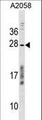 Coiled-Coil Domain Containing 144 Family, N-Terminal Like antibody, LS-C159283, Lifespan Biosciences, Western Blot image 