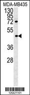 Pyrin And HIN Domain Family Member 1 antibody, 61-908, ProSci, Western Blot image 