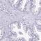 Troponin I3, Cardiac Type antibody, HPA046428, Atlas Antibodies, Immunohistochemistry paraffin image 