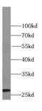 TPI antibody, FNab08887, FineTest, Western Blot image 