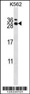 RCAN Family Member 3 antibody, 57-705, ProSci, Western Blot image 