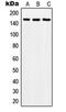 SOS Ras/Rho Guanine Nucleotide Exchange Factor 2 antibody, orb214600, Biorbyt, Western Blot image 