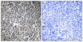 Myosin Phosphatase Rho Interacting Protein antibody, abx014614, Abbexa, Western Blot image 