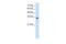 Transient Receptor Potential Cation Channel Subfamily M Member 5 antibody, PA5-41040, Invitrogen Antibodies, Western Blot image 