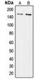 Collagen Type V Alpha 3 Chain antibody, MBS820976, MyBioSource, Western Blot image 