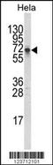 Deltex E3 Ubiquitin Ligase 1 antibody, 63-705, ProSci, Western Blot image 