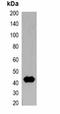 T7 epitope tag antibody, orb323065, Biorbyt, Western Blot image 