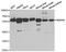 Regulator Of Microtubule Dynamics 3 antibody, STJ28383, St John