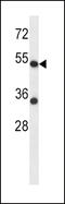 Adrenoceptor Alpha 2C antibody, 57-834, ProSci, Western Blot image 