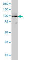 ATPase Sarcoplasmic/Endoplasmic Reticulum Ca2+ Transporting 3 antibody, LS-B6010, Lifespan Biosciences, Western Blot image 