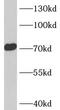 Amiloride-sensitive cation channel 4 antibody, FNab00639, FineTest, Western Blot image 