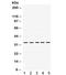 TIMP Metallopeptidase Inhibitor 3 antibody, R32078, NSJ Bioreagents, Western Blot image 