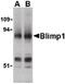 PR/SET Domain 1 antibody, PA5-20313, Invitrogen Antibodies, Western Blot image 