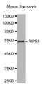 Receptor Interacting Serine/Threonine Kinase 3 antibody, MBS2517313, MyBioSource, Western Blot image 