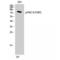 Protein Kinase C Delta antibody, LS-C380823, Lifespan Biosciences, Western Blot image 