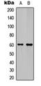 Ephrin B1 antibody, orb304742, Biorbyt, Western Blot image 