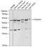 ATPase H+ Transporting Accessory Protein 2 antibody, 22-290, ProSci, Western Blot image 