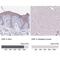 Desmoplakin antibody, NBP2-49158, Novus Biologicals, Immunohistochemistry paraffin image 