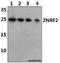 Zinc And Ring Finger 2 antibody, A11505-1, Boster Biological Technology, Western Blot image 
