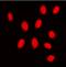 Mitogen-Activated Protein Kinase Kinase 3 antibody, orb223989, Biorbyt, Immunofluorescence image 