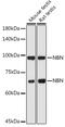 Nibrin antibody, GTX35197, GeneTex, Western Blot image 