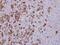 X-Linked Inhibitor Of Apoptosis antibody, PA5-29253, Invitrogen Antibodies, Immunohistochemistry paraffin image 