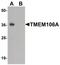 Transmembrane Protein 106A antibody, PA5-34352, Invitrogen Antibodies, Western Blot image 