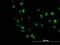 Transcription Factor 4 antibody, H00006925-M04, Novus Biologicals, Immunocytochemistry image 