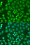 Diacylglycerol Kinase Epsilon antibody, A06615-1, Boster Biological Technology, Western Blot image 
