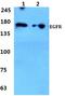 EGFR antibody, A00023S1064, Boster Biological Technology, Western Blot image 