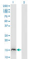 Retinol Binding Protein 2 antibody, LS-C198071, Lifespan Biosciences, Western Blot image 