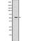 Serine/Threonine Kinase 3 antibody, abx218801, Abbexa, Western Blot image 