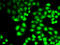 Glucokinase antibody, STJ28215, St John