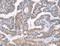 Adaptor Related Protein Complex 1 Subunit Beta 1 antibody, LS-C406127, Lifespan Biosciences, Immunohistochemistry paraffin image 