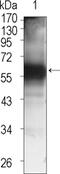 Tyrosine-protein kinase Tec antibody, M01031, Boster Biological Technology, Western Blot image 