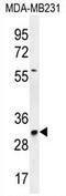 TNF Alpha Induced Protein 8 Like 3 antibody, AP54306PU-N, Origene, Western Blot image 