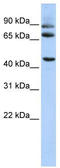 Inactive dipeptidyl peptidase 10 antibody, TA335318, Origene, Western Blot image 
