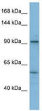 Sarcoplasmic/endoplasmic reticulum calcium ATPase 1 antibody, TA346377, Origene, Western Blot image 