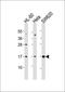 AlkB Homolog 8, TRNA Methyltransferase antibody, orb373549, Biorbyt, Western Blot image 