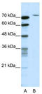 TATA-Box Binding Protein Associated Factor 6 antibody, TA343550, Origene, Western Blot image 