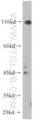 Purinergic Receptor P2X 5 antibody, 19012-1-AP, Proteintech Group, Western Blot image 