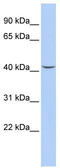 Septin 2 antibody, TA345163, Origene, Western Blot image 