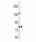 Carnitine Palmitoyltransferase 1B antibody, F44997-0.4ML, NSJ Bioreagents, Western Blot image 