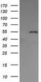 Protein Disulfide Isomerase Family A Member 3 antibody, M01464-3, Boster Biological Technology, Western Blot image 