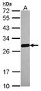 Mediator Complex Subunit 18 antibody, NBP2-17257, Novus Biologicals, Western Blot image 